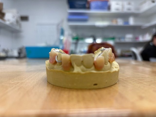 A removable partial denture on a model at the Trout Dental Laboratory bench.